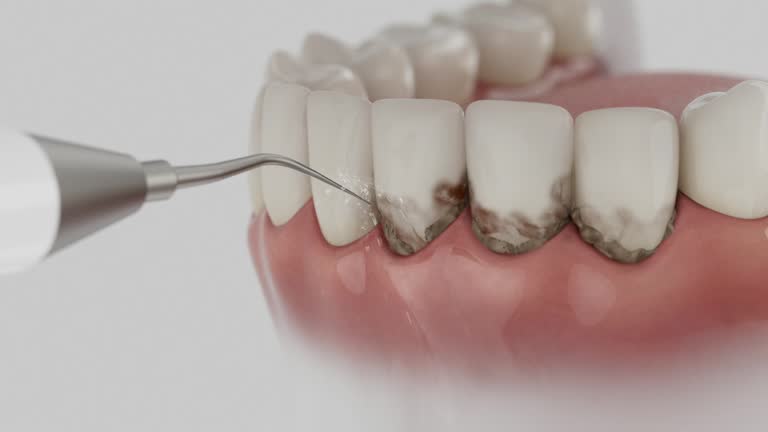 Reliable Emergency Dentist contractor in McLeansboro, IL by Smile Center Dentistry